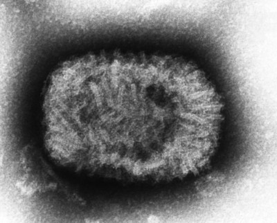 Altamente ampliada em 310 mil X, este micrografia negativo manchada eletrônica de transmissão (TEM) mostrava uma partícula varíola (varíola) do vírus, ou um único "virion". Autor: CDC/ J. Nakano - 1968